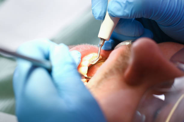Trusted MO Emergency Dentist Experts